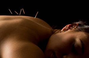 Acupuncture for Pain Relief UK