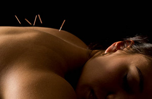 Acupuncture for Pain Relief Blackburn