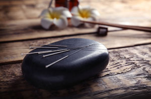 Acupuncture Near Me Saffron Walden