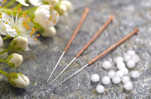 Acupuncture Needles Calne - Acupuncture Points