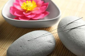 Acupuncture Near Me Ealing