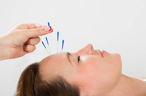 Acupuncture Ewell