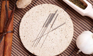 Acupuncture Needles Kirkby-in-Ashfield - Acupuncture Points