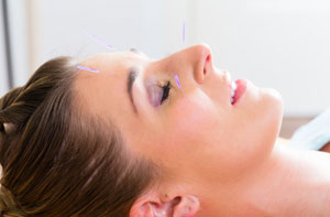 Acupuncturists in Saffron Walden (01799)