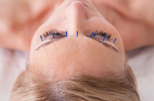 Acupuncturists Bournemouth UK