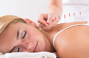 Acupuncturists in Wombwell (01226)