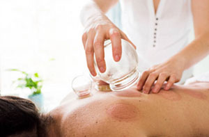 Cupping Therapy Polesworth