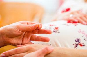 Acupuncture Near Me Canvey Island