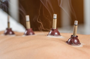 Moxibustion Cardiff (029)